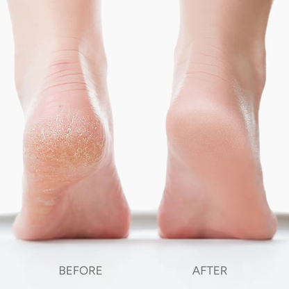 SmoothSole Pro